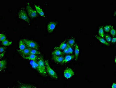 PRKCZ Antibody