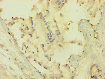 AKT1 Antibody
