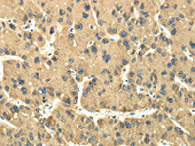TULP2 Antibody