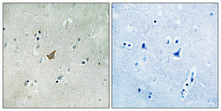 Phospho-EPHA3 (Tyr779/833) Antibody