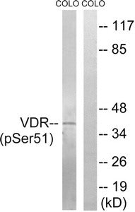 Phospho-VDR (Ser51) Antibody
