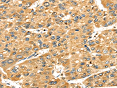 SH3KBP1 Antibody