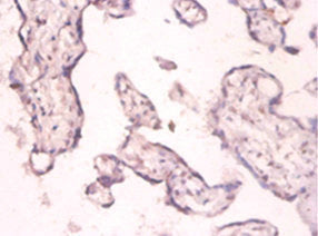 PKMYT1 Antibody