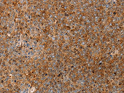 SERPINB2 Antibody