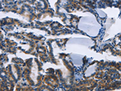 TWF2 Antibody