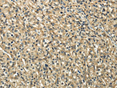 TUBA1C Antibody