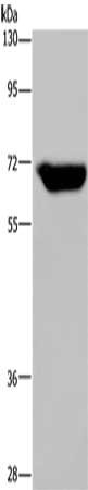 JMJD6 Antibody