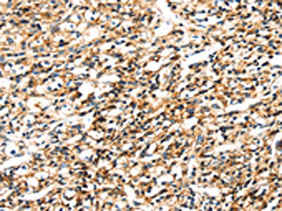 SEMA4A Antibody