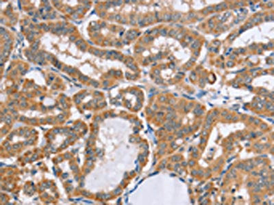 MSMB Antibody