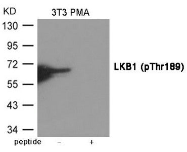 Phospho-STK11 (Thr189) Antibody