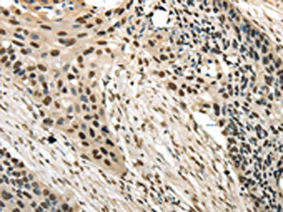 TRIM11 Antibody