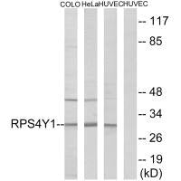 RPS4Y1 Antibody