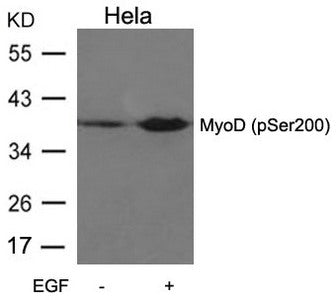 Phospho-MYOD1 (Ser200) Antibody