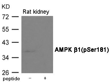 Phospho-PRKAB1 (Ser181) Antibody