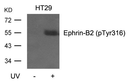 Phospho-EFNB2 (Tyr316) Antibody