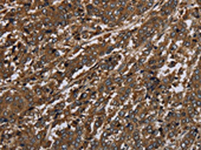 HPGD Antibody