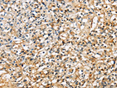 SDCBP Antibody