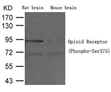 Phospho-OPRM1 (Ser375) Antibody