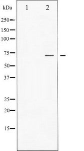 FOXO1 Antibody