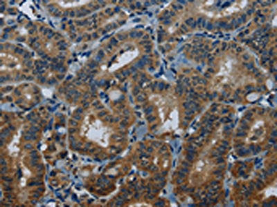 MEI1 Antibody