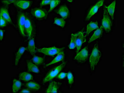 DST Antibody