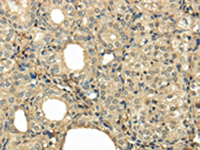UBE2B Antibody