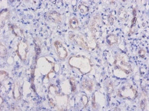 Havcr1 Antibody