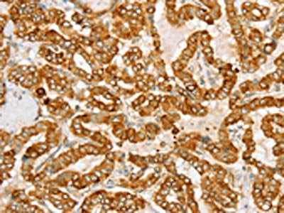 PTPN22 Antibody
