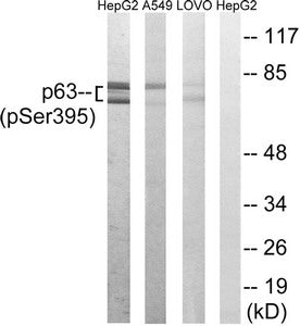 Phospho-TP63 (Ser395) Antibody