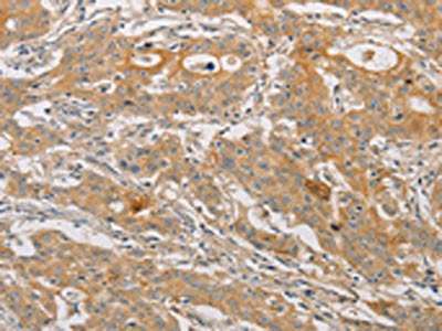 ARSK Antibody