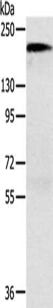 ACE Antibody