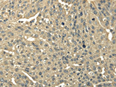 TRIB2 Antibody