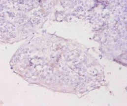 MT1E Antibody