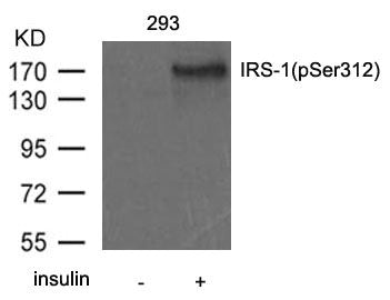Phospho-IRS1 (Ser312) Antibody