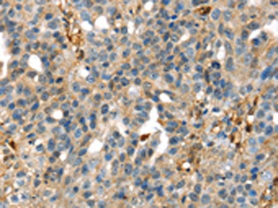 SERPINB6 Antibody