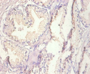 MT1A Antibody