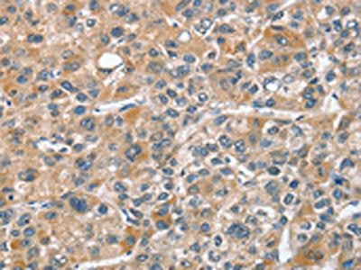 CHMP4B Antibody