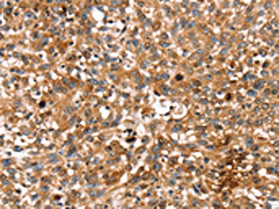 STAR Antibody