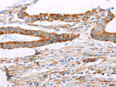 ATP5J Antibody