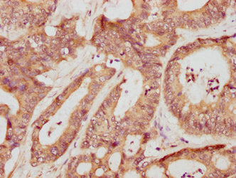 Mmp3 Antibody