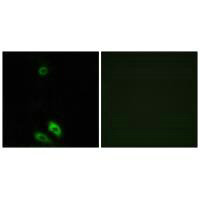 AKR1CL1 Antibody