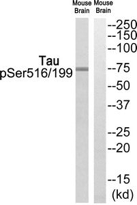 Phospho-MAPT (Ser516/199) Antibody