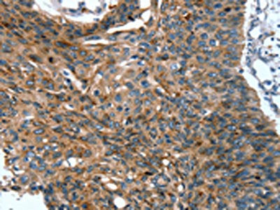 SCPEP1 Antibody