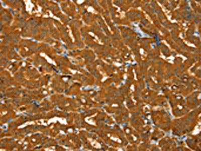 PYGM Antibody