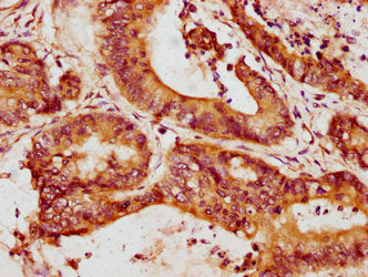 Mmp13 Antibody