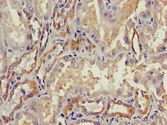 TGFB3 Antibody