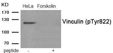 Phospho-VCL (Tyr822) Antibody