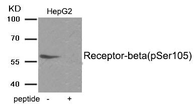 Phospho-ESR2 (Ser105) Antibody