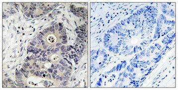 Phospho-NOS2 (Tyr151) Antibody