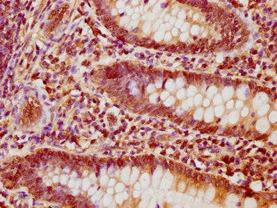 NFATC1 Antibody